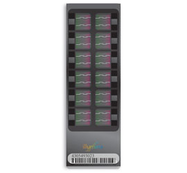 PorcineSNP60 DNA Analysis Kit