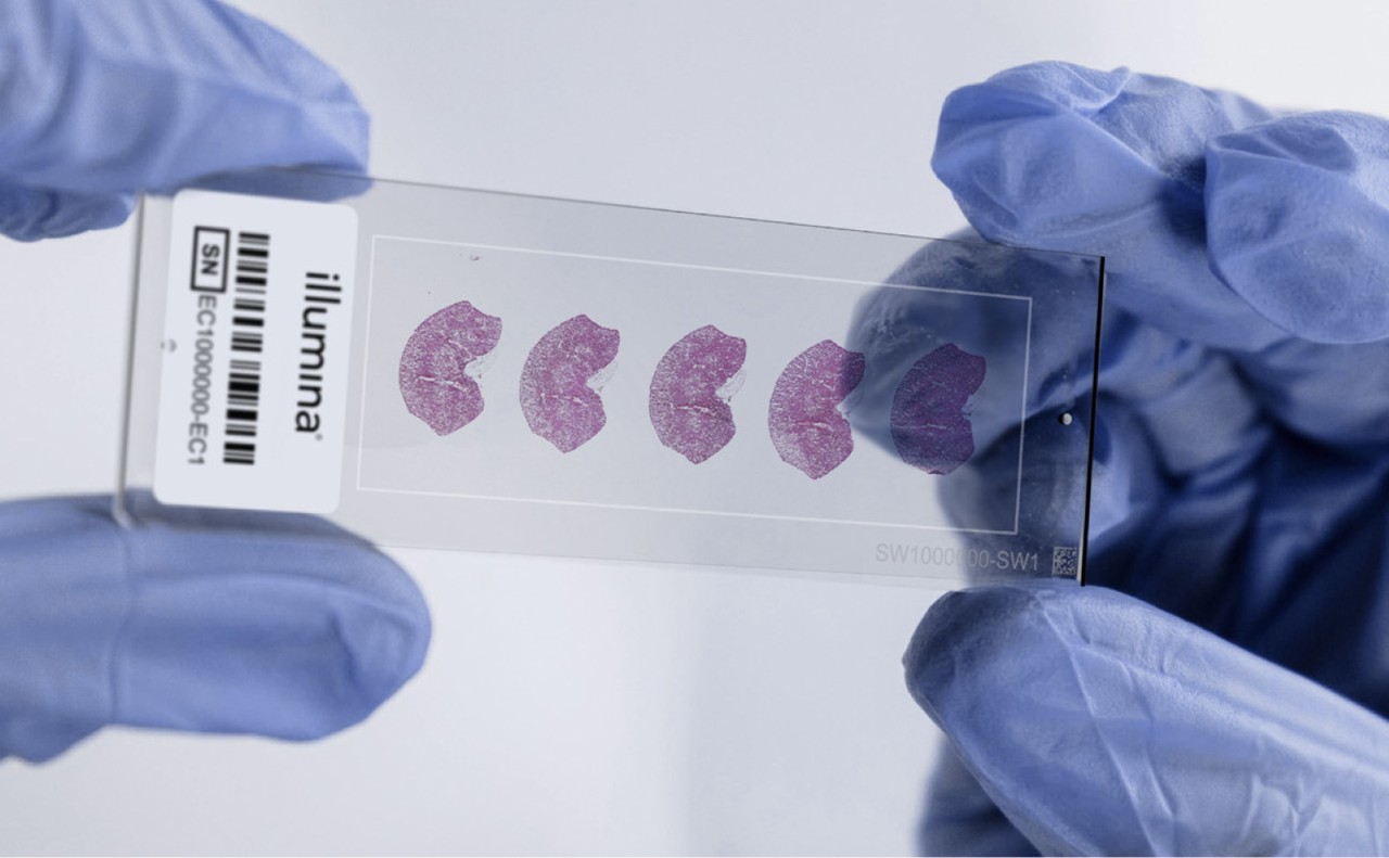 Tissue preparation for spatial transcriptomics